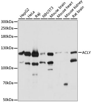 ACLY Polyclonal Antibody (50 µl)