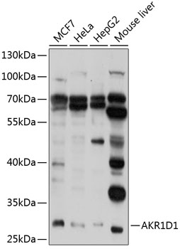 AKR1D1 Polyclonal Antibody (100 µl)