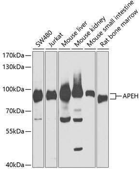 APEH Polyclonal Antibody (50 µl)