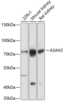 ASAH2 Polyclonal Antibody (100 µl)