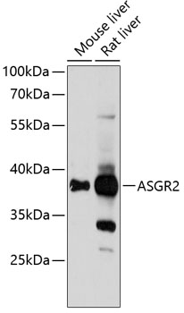 ASGR2 Polyclonal Antibody (50 µl)