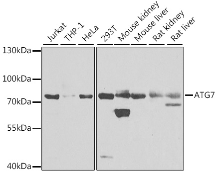 ATG7 Polyclonal Antibody (50 µl)