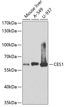 CES1 Polyclonal Antibody (50 µl)