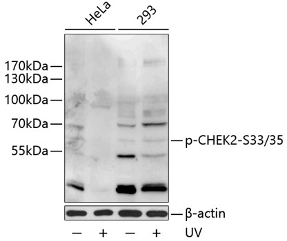 Phospho-CHEK2-S33/35 Polyclonal Antibody (50 µl)