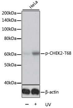 Phospho-CHEK2-T68 Polyclonal Antibody (100 µl)