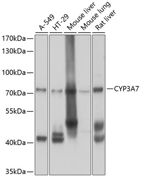 CYP3A7 Polyclonal Antibody (100 µl)