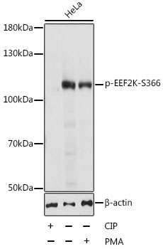 Phospho-EEF2K-S366 Polyclonal Antibody