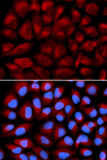 FANCC Polyclonal Antibody (50 µl)