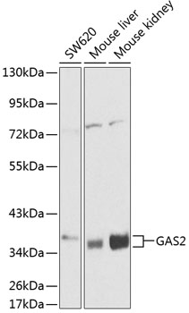 GAS2 Polyclonal Antibody (50 µl)