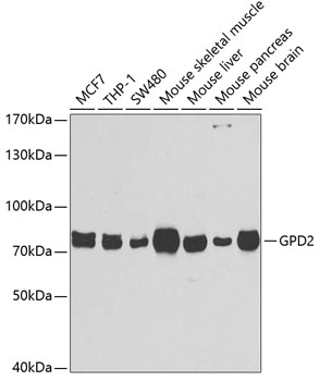 GPD2 Polyclonal Antibody (100 µl)