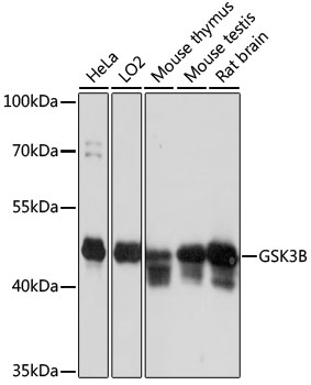 GSK3B Polyclonal Antibody (100 µl)