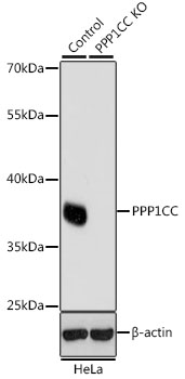 PPP1CC Polyclonal Antibody (100 µl)