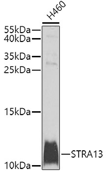 STRA13 Polyclonal Antibody (50 µl)