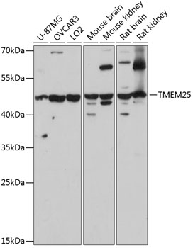TMEM25 Polyclonal Antibody