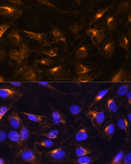 Vimentin Polyclonal Antibody