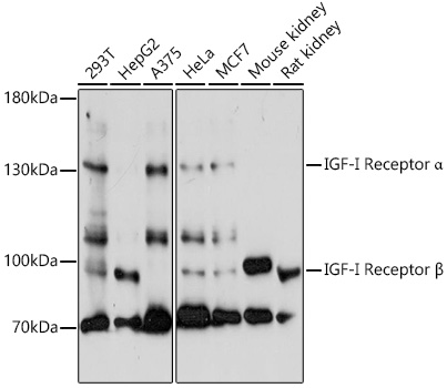 IGF1R Polyclonal Antibody (50 µl)