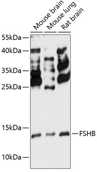 FSHB Polyclonal Antibody (50 µl)