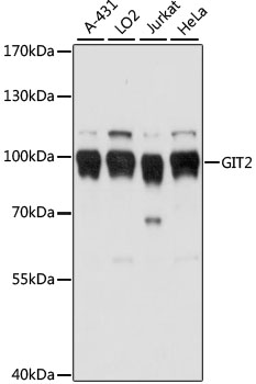 GIT2 Polyclonal Antibody (100 µl)