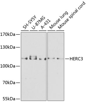 HERC3 Polyclonal Antibody (100 µl)