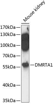 DMRTA1 Polyclonal Antibody (100 µl)
