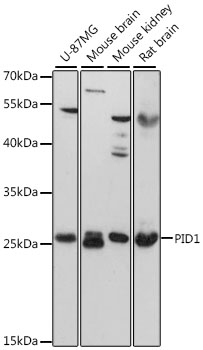 PID1 Polyclonal Antibody (50 µl)