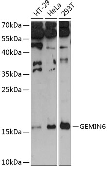 GEMIN6 Polyclonal Antibody (100 µl)