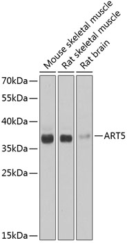 ART5 Polyclonal Antibody (50 µl)