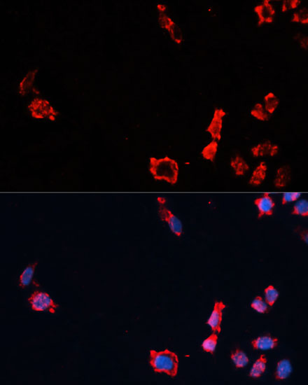 CASP10 Polyclonal Antibody (100 µl)