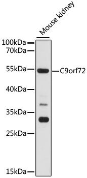C9orf72 Polyclonal Antibody (100 µl)