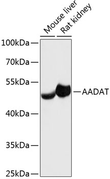 AADAT Polyclonal Antibody (100 µl)