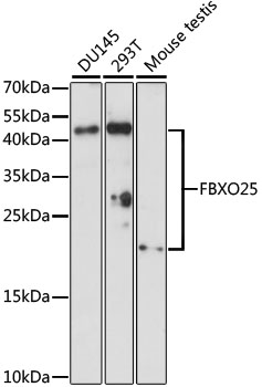 FBXO25 Polyclonal Antibody (50 µl)