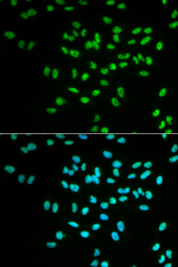 FANCD2 Polyclonal Antibody (100 µl)