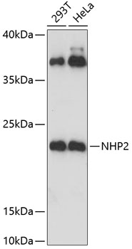 NHP2 Polyclonal Antibody (100 µl)