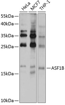 ASF1B Polyclonal Antibody (50 µl)