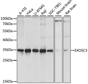EXOSC3 Polyclonal Antibody (100 µl)
