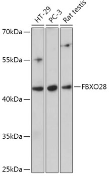 FBXO28 Polyclonal Antibody (50 µl)