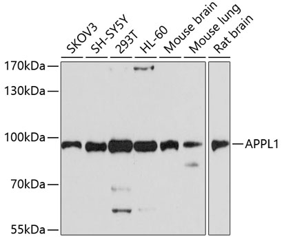 APPL1 Polyclonal Antibody (100 µl)
