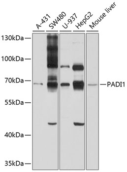 PADI1 Polyclonal Antibody (100 µl)