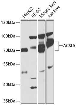 ACSL5 Polyclonal Antibody (50 µl)