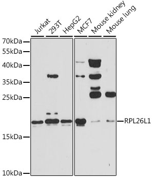 RPL26L1 Polyclonal Antibody