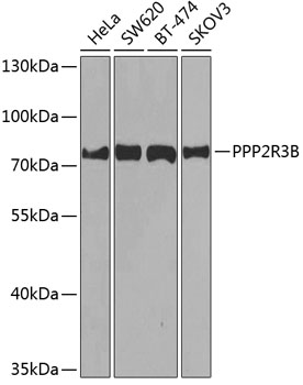 PPP2R3B Polyclonal Antibody (50 µl)