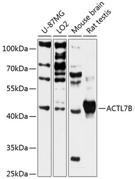 ACTL7B Polyclonal Antibody (50 µl)