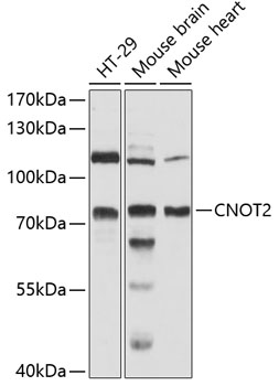 CNOT2 Polyclonal Antibody (50 µl)