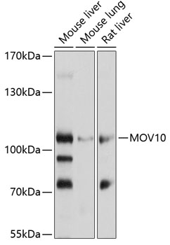 MOV10 Polyclonal Antibody (100 µl)
