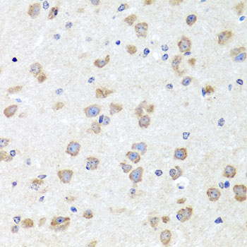 CHD1 Polyclonal Antibody (50 µl)