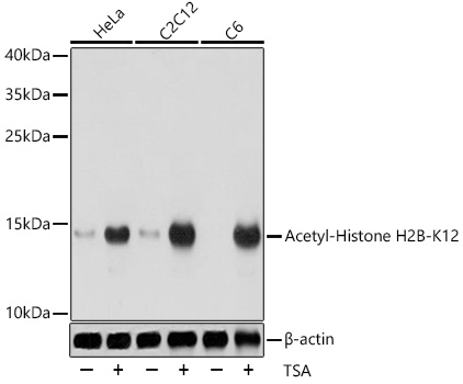 Histone H2BK12ac (Acetyl H2BK12) Polyclonal Antibody (100 µl)