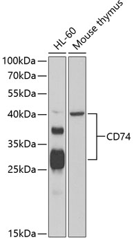 CD74 Polyclonal Antibody (50 µl)