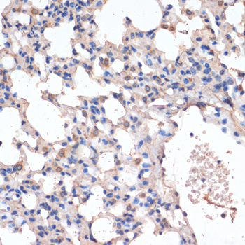 CD163 Polyclonal Antibody (100 µl)