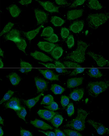 Bcl2 Polyclonal Antibody (50 µl)