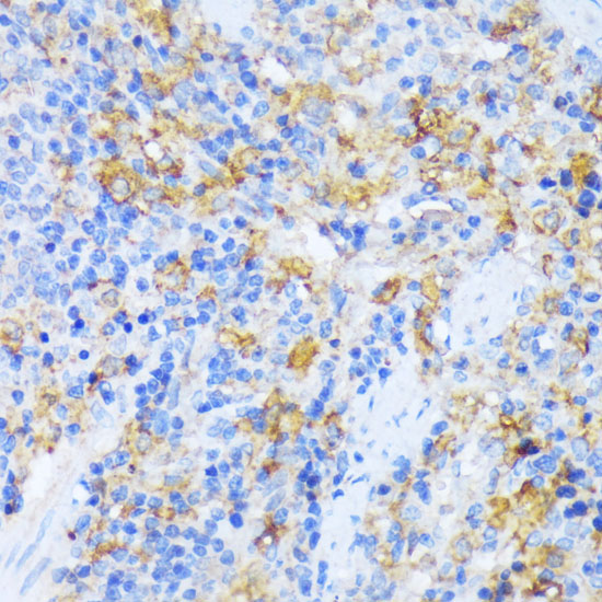 AARS Polyclonal Antibody (100 µl)